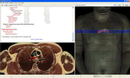 VH Dissector Anatomy 4.5.1 + Update to 4.5.2 [repost]