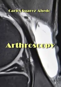"Arthroscopy" ed. by Carlos Suarez-Ahedo