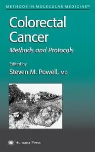 Colorectal Cancer: Methods and Protocols (Methods in Molecular Medicine) by Steven M. Powell