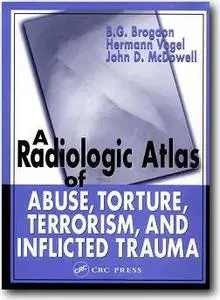 B. G. Brogdon, Hermann Vogel, John D. McDowell, «A Radiologic Atlas of Abuse, Torture, Terrorism, and Inflicted Trauma»