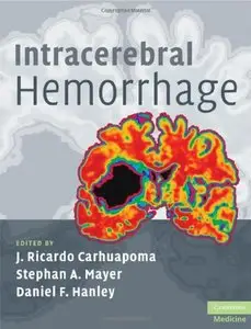 Intracerebral Hemorrhage (repost)