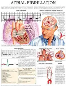Atrial fibrillation e-chart: Quick reference guide