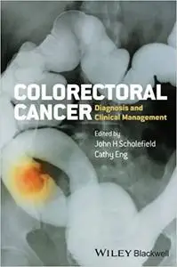 Colorectal Cancer: Diagnosis and Clinical Management