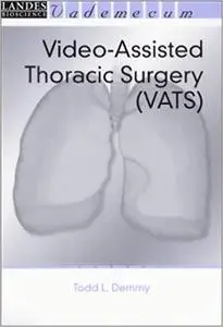 Video-Assisted Thoracic Surgery (VATS)