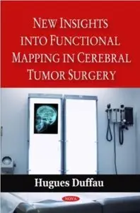 New Insights into Functional Mapping in Cerebral Tumor Surgery