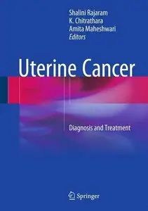 Uterine Cancer: Diagnosis and Treatment (Repost)