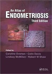 Atlas of Endometriosis  Ed 3