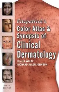 Fitzpatrick Color Atlas and Synopsis of Clinical Dermatology (Fitzpatrick's Color Atlas & Synopsis of Clinical Dermatology)