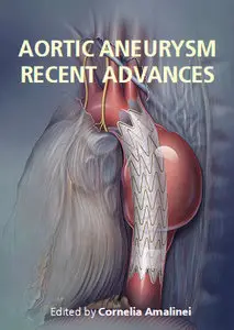 "Aortic Aneurysm: Recent Advances" ed. by Cornelia Amalinei