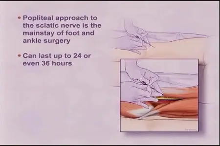 Atlas Of Peripheral Nerve Blocks And Anatomy For Orthopaedic Anesthesia