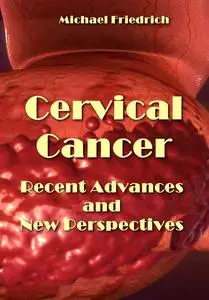 "Cervical Cancer: Recent Advances and New Perspectives" ed. by Michael Friedrich
