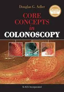 Core Concepts in Colonoscopy(Repost)