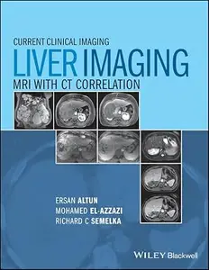 Liver Imaging: MRI with CT Correlation