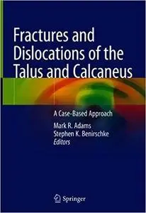 Fractures and Dislocations of the Talus and Calcaneus: A Case-Based Approach