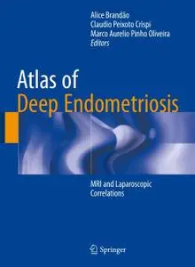 Atlas of Deep Endometriosis: MRI and Laparoscopic Correlations (Repost)