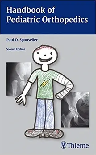 Handbook of Pediatric Orthopedics (2nd Edition)