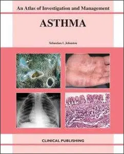 Asthma: An Atlas of Investigation and Diagnosis