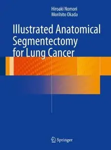Illustrated Anatomical Segmentectomy for Lung Cancer 