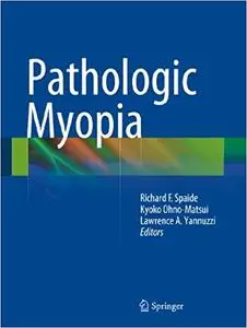 Pathologic Myopia (Repost)