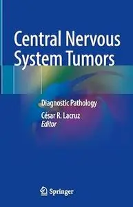 Central Nervous System Tumors