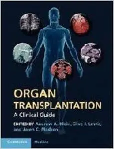 Organ Transplantation: A Clinical Guide