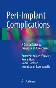 Peri-Implant Complications: A Clinical Guide to Diagnosis and Treatment (Repost)