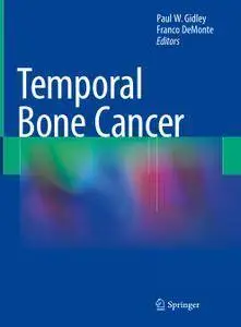 Temporal Bone Cancer (repost)
