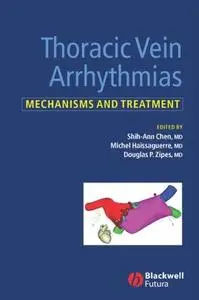 Thoracic Vein Arrhythmias: Mechanisms and Treatment