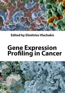 "Gene Expression Profiling in Cancer" ed. by Dimitrios Vlachakis