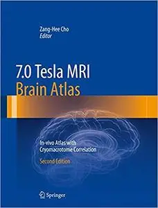 7.0 Tesla MRI Brain Atlas: In-vivo Atlas with Cryomacrotome Correlation (Repost)