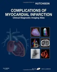 Complications of Myocardial Infarction: Clinical Diagnostic Imaging Atlas (repost)