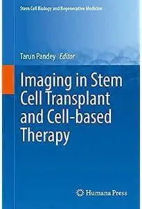 Imaging in Stem Cell Transplant and Cell-based Therapy [Repost]
