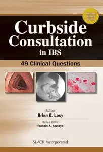 Curbside Consultation in IBS: 49 Clinical Questions (Repost)