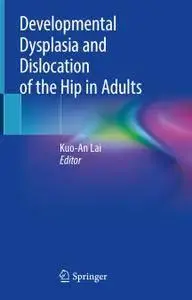 Developmental Dysplasia and Dislocation of the Hip in Adults (repost)