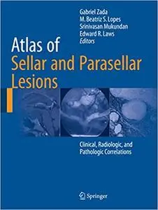 Atlas of Sellar and Parasellar Lesions: Clinical, Radiologic, and Pathologic Correlations