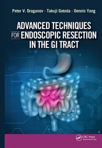 Advanced Techniques for Endoscopic Resection in the GI Tract