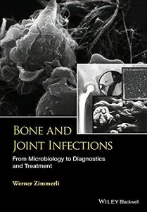 Bone and Joint Infections: From Microbiology to Diagnostics and Treatment