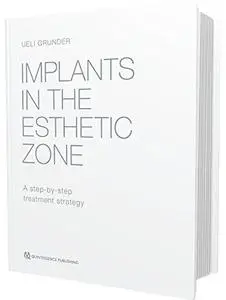 Implants in the Esthetic Zone: A Step-by-Step Treatment Strategy