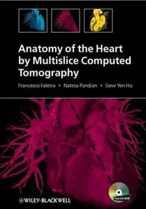 Anatomy of the Heart by Multislice Computed Tomography