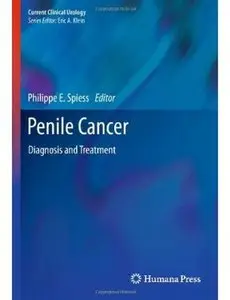 Penile Cancer: Diagnosis and Treatment