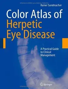 Color Atlas of Herpetic Eye Disease [Repost]