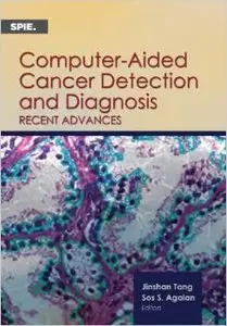 Computer-Aided Cancer Detection and Diagnosis: Recent Advances