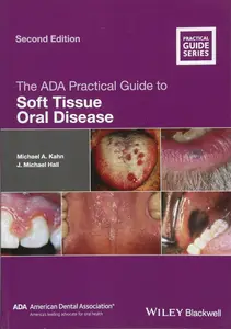 The ADA Practical Guide to Soft Tissue Oral Disease