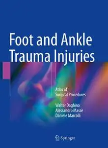Foot and Ankle Trauma Injuries: Atlas of Surgical Procedures (Repost)