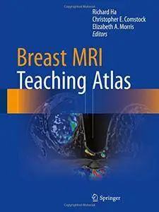 Breast MRI Teaching Atlas [Repost]