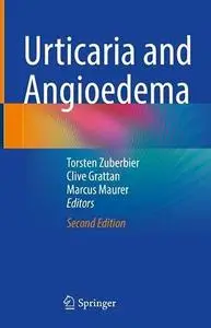 Urticaria and Angioedema, Second Edition