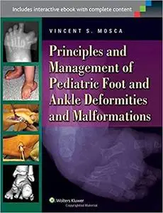 Principles and Management of Pediatric Foot and Ankle Deformities and Malformations (Repost)