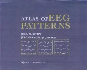 An Atlas of EEG Patterns