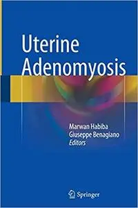 Uterine Adenomyosis (Repost)