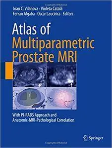 Atlas of Multiparametric Prostate MRI: With PI-RADS Approach and Anatomic-MRI-Pathological Correlation